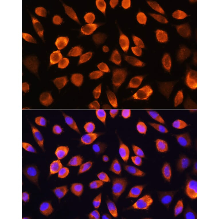 Immunofluorescence - Anti-Hsc70 Antibody (A91017) - Antibodies.com