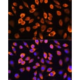 Immunofluorescence - Anti-Hsc70 Antibody (A91017) - Antibodies.com