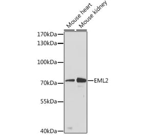 Western Blot - Anti-EML2 Antibody (A91019) - Antibodies.com