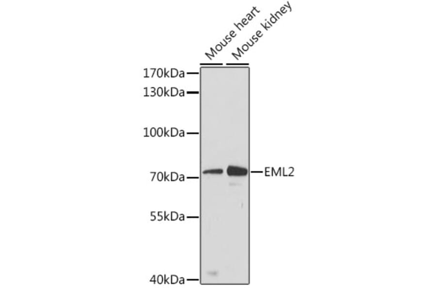 Western Blot - Anti-EML2 Antibody (A91019) - Antibodies.com