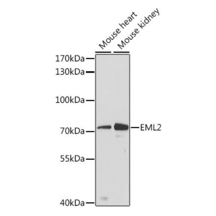 Western Blot - Anti-EML2 Antibody (A91019) - Antibodies.com