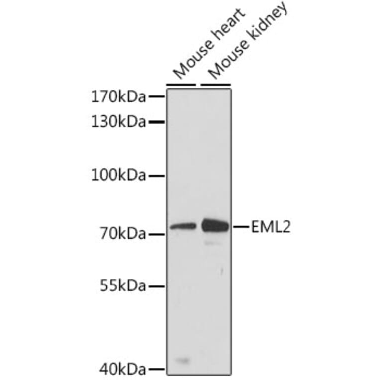 Western Blot - Anti-EML2 Antibody (A91019) - Antibodies.com