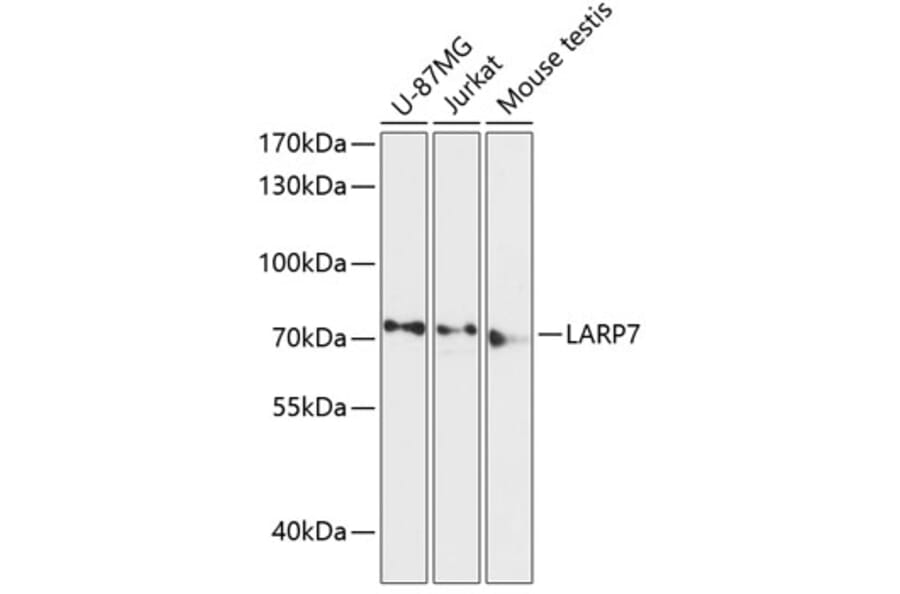 Western Blot - Anti-LARP7 Antibody (A91020) - Antibodies.com