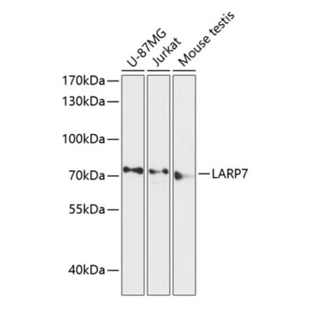 Western Blot - Anti-LARP7 Antibody (A91020) - Antibodies.com