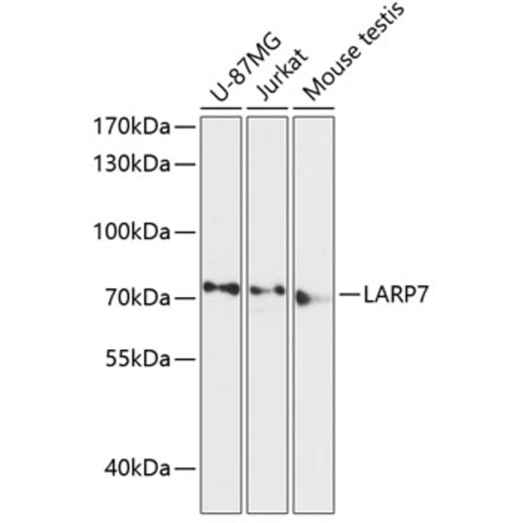 Western Blot - Anti-LARP7 Antibody (A91020) - Antibodies.com