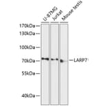 Western Blot - Anti-LARP7 Antibody (A91020) - Antibodies.com