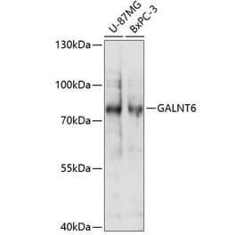 Western Blot - Anti-GALNT6 Antibody (A91022) - Antibodies.com