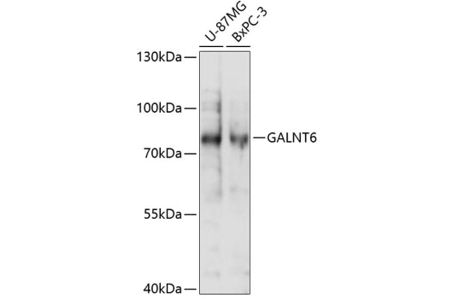 Western Blot - Anti-GALNT6 Antibody (A91022) - Antibodies.com