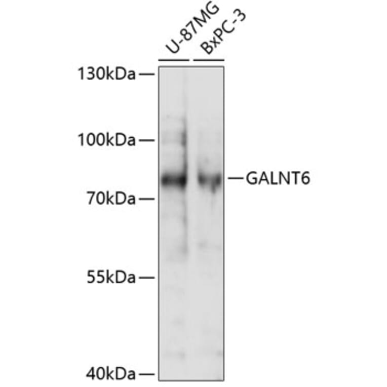 Western Blot - Anti-GALNT6 Antibody (A91022) - Antibodies.com