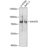 Western Blot - Anti-GALNT6 Antibody (A91022) - Antibodies.com