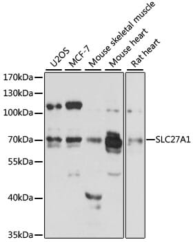 Western blot analysis of extracts of various cell lines, using Anti-SLC27A1 Antibody (A12847) at 1:3000 dilution.
Secondary antibody: Goat Anti-Rabbit IgG (H+L) (HRP) (AS014) at 1:10,000 dilution.
Lysates / proteins: 25µg per lane.
Blocking buffer: 3% non-fat dry milk in TBST.
Detection: ECL Enhanced Kit (RM00021).
Exposure time: 30s.