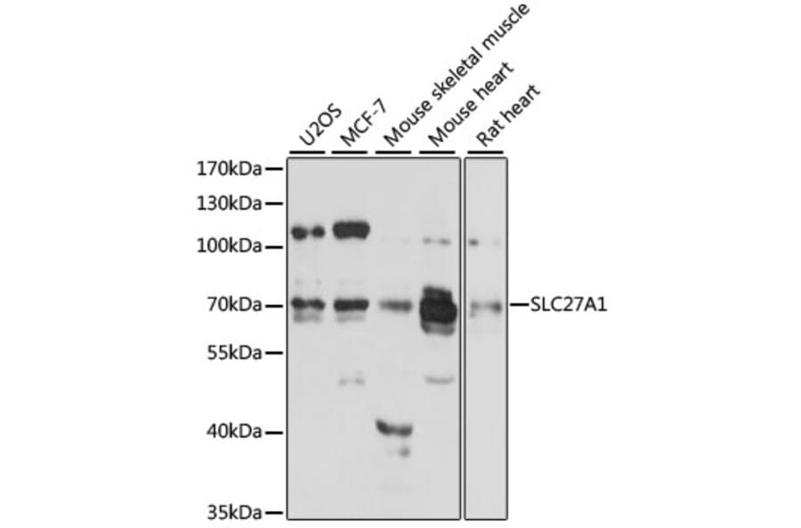 Western Blot - Anti-FATP1 Antibody (A91024) - Antibodies.com