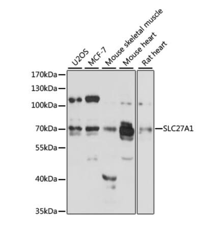 Western Blot - Anti-FATP1 Antibody (A91024) - Antibodies.com