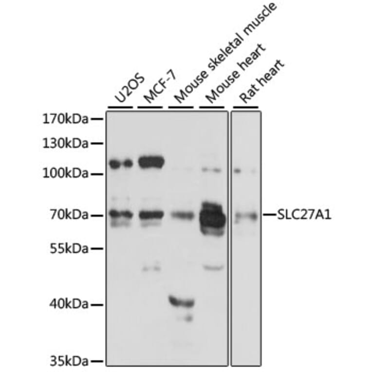 Western Blot - Anti-FATP1 Antibody (A91024) - Antibodies.com