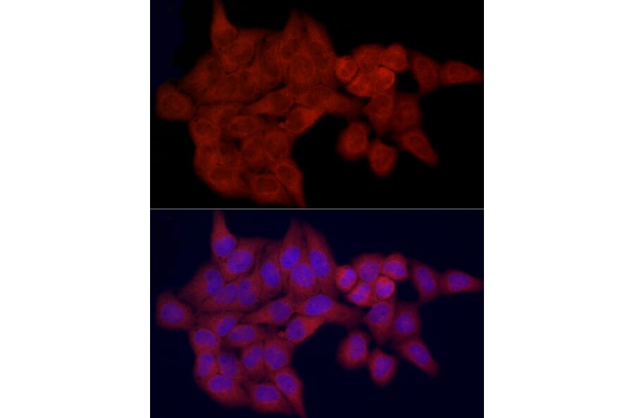 Immunofluorescence - Anti-FATP1 Antibody (A91024) - Antibodies.com