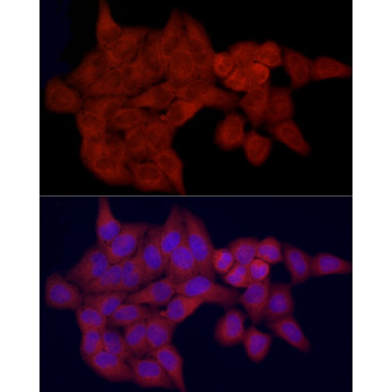 Immunofluorescence - Anti-FATP1 Antibody (A91024) - Antibodies.com