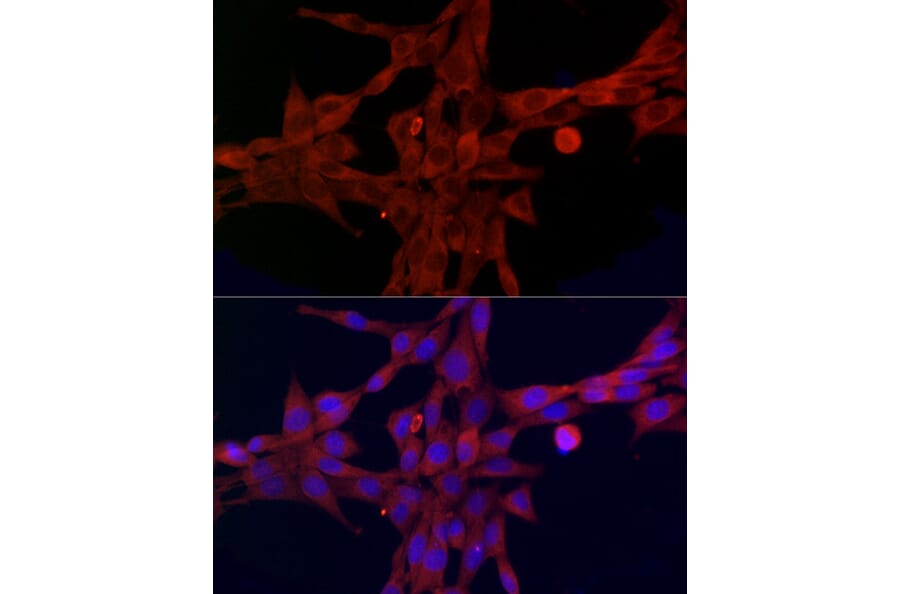 Immunofluorescence - Anti-FATP1 Antibody (A91024) - Antibodies.com