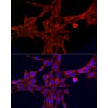 Immunofluorescence - Anti-FATP1 Antibody (A91024) - Antibodies.com