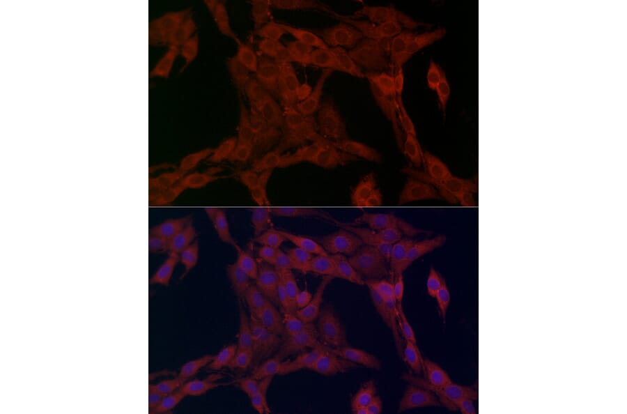 Immunofluorescence - Anti-FATP1 Antibody (A91024) - Antibodies.com