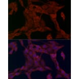 Immunofluorescence - Anti-FATP1 Antibody (A91024) - Antibodies.com