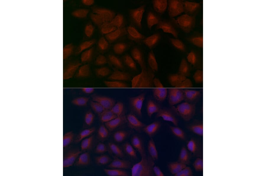 Immunofluorescence - Anti-FATP1 Antibody (A91024) - Antibodies.com