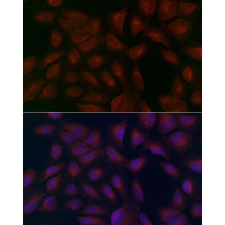 Immunofluorescence - Anti-FATP1 Antibody (A91024) - Antibodies.com