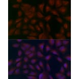 Immunofluorescence - Anti-FATP1 Antibody (A91024) - Antibodies.com