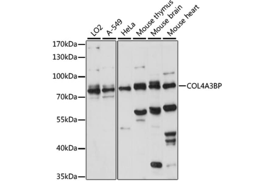 Western Blot - Anti-CERT Antibody (A91025) - Antibodies.com