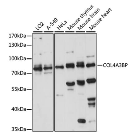 Western Blot - Anti-CERT Antibody (A91025) - Antibodies.com