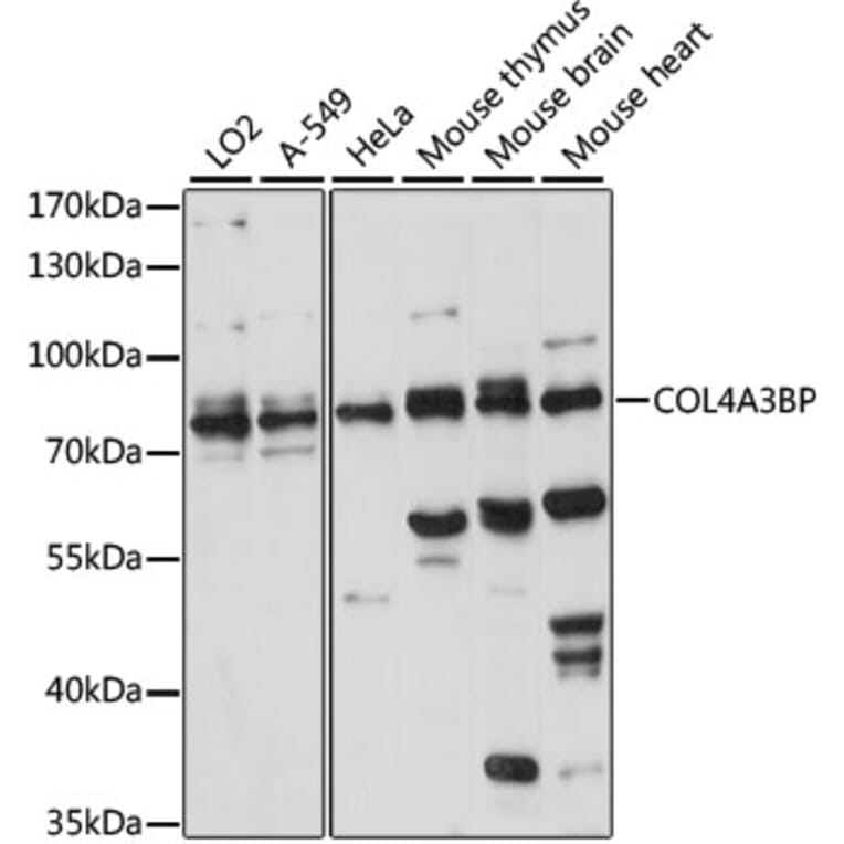 Western Blot - Anti-CERT Antibody (A91025) - Antibodies.com