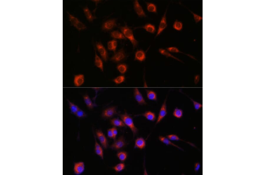 Immunofluorescence - Anti-CERT Antibody (A91025) - Antibodies.com