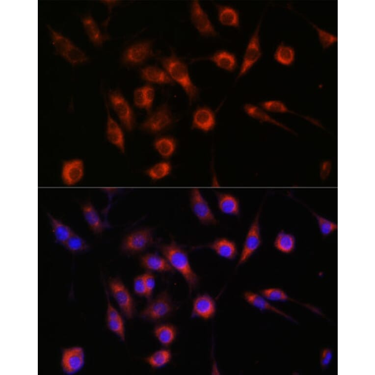 Immunofluorescence - Anti-CERT Antibody (A91025) - Antibodies.com