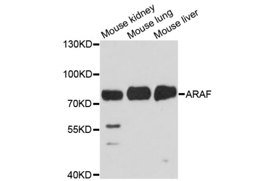 Western Blot - Anti-ARAF Antibody (A14704) - Antibodies.com