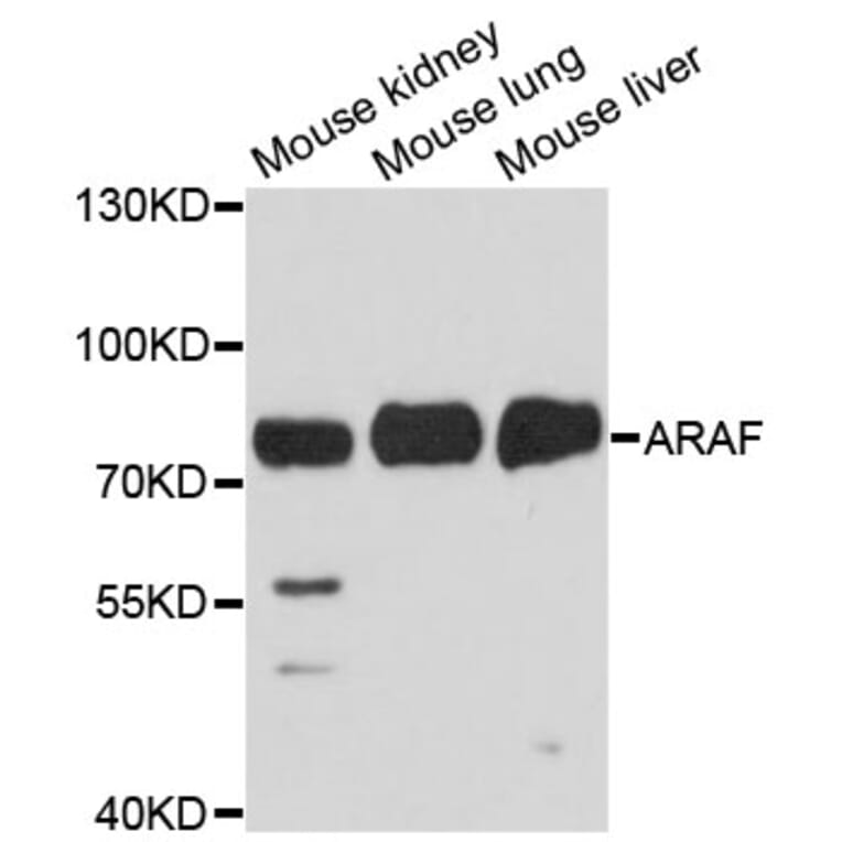 Western Blot - Anti-ARAF Antibody (A14704) - Antibodies.com