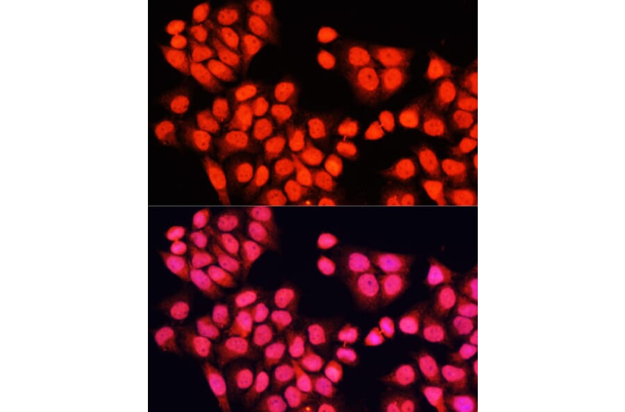 Immunofluorescence - Anti-ARAF Antibody (A14704) - Antibodies.com