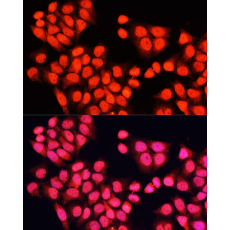 Immunofluorescence - Anti-ARAF Antibody (A14704) - Antibodies.com