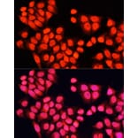 Immunofluorescence - Anti-ARAF Antibody (A14704) - Antibodies.com