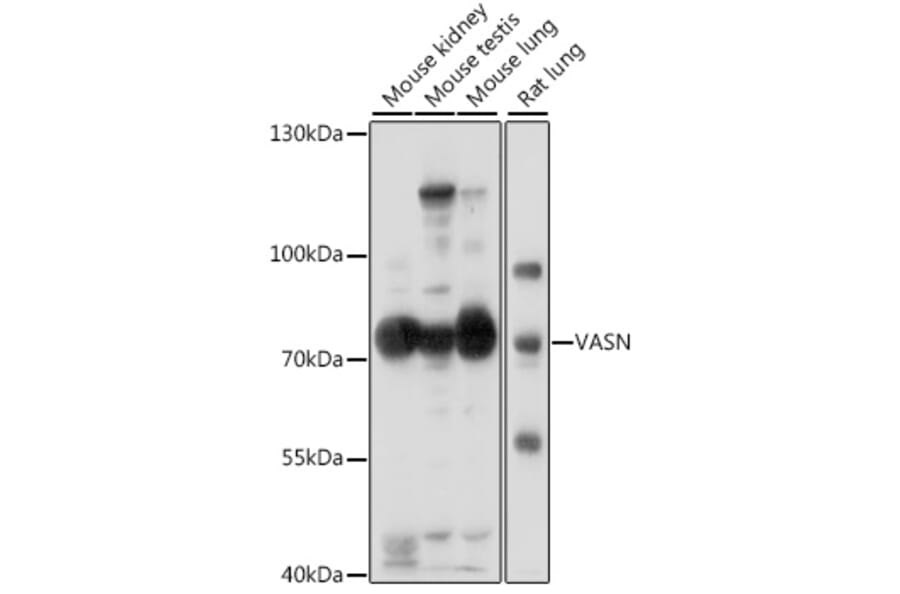 Western Blot - Anti-Vasorin Antibody (A91027) - Antibodies.com