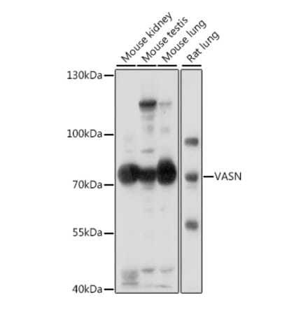 Western Blot - Anti-Vasorin Antibody (A91027) - Antibodies.com
