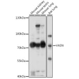 Western Blot - Anti-Vasorin Antibody (A91027) - Antibodies.com