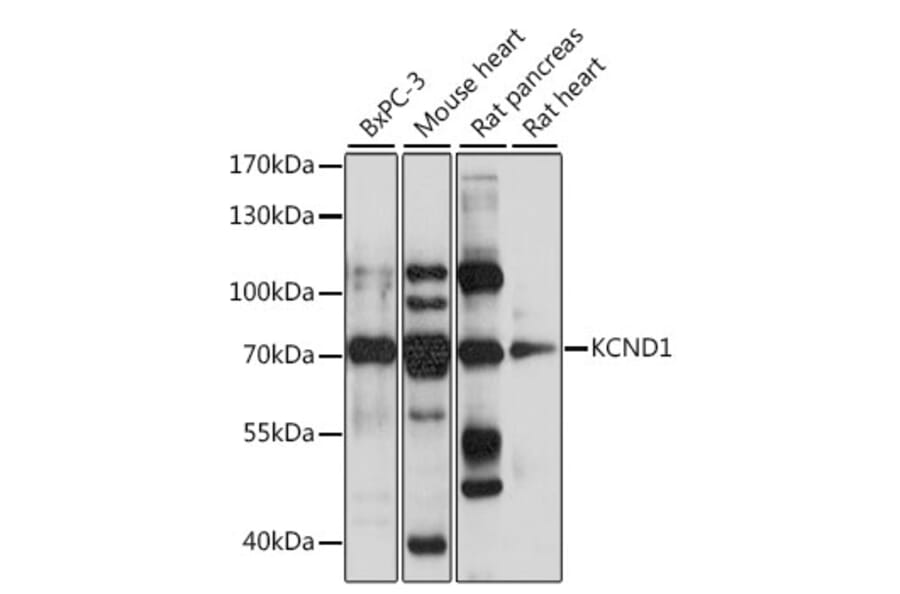 Western Blot - Anti-KCND1 Antibody (A15683) - Antibodies.com