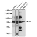Western Blot - Anti-KCND1 Antibody (A15683) - Antibodies.com