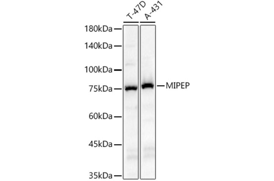Western Blot - Anti-MIPEP Antibody (A91029) - Antibodies.com