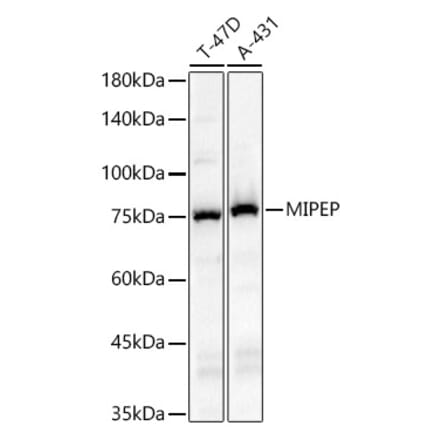 Western Blot - Anti-MIPEP Antibody (A91029) - Antibodies.com