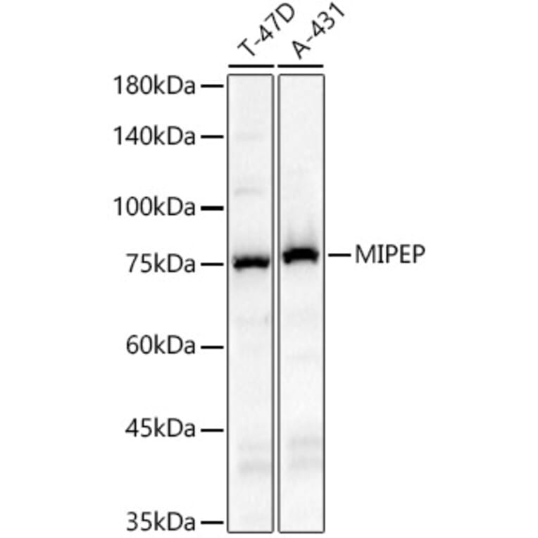 Western Blot - Anti-MIPEP Antibody (A91029) - Antibodies.com