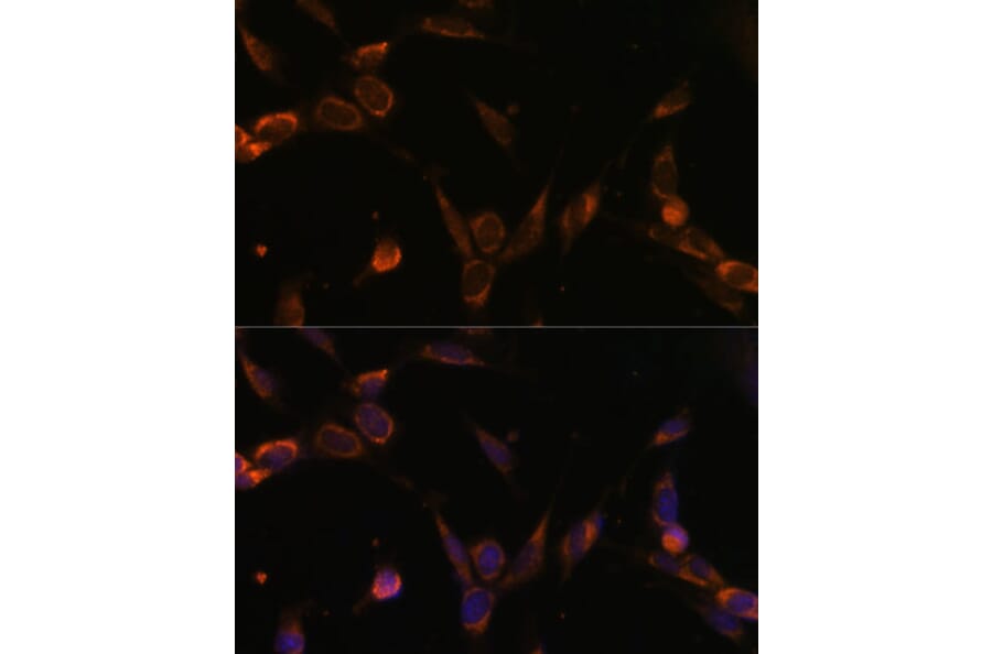 Immunofluorescence - Anti-USP30 Antibody (A91031) - Antibodies.com
