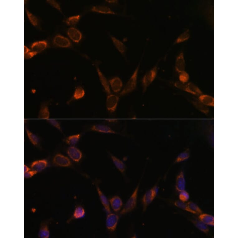 Immunofluorescence - Anti-USP30 Antibody (A91031) - Antibodies.com