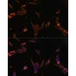 Immunofluorescence - Anti-USP30 Antibody (A91031) - Antibodies.com