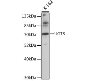 Western Blot - Anti-CGT Antibody (A91032) - Antibodies.com