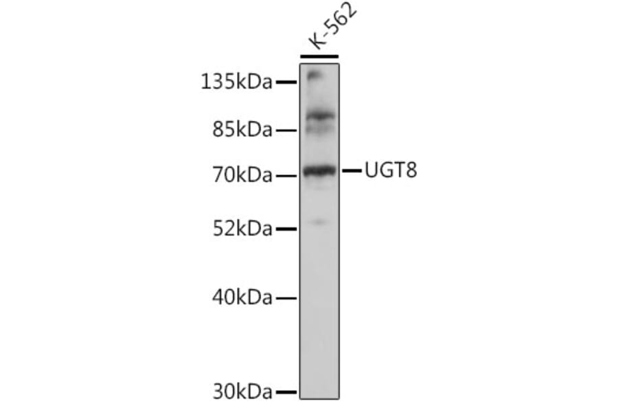 Western Blot - Anti-CGT Antibody (A91032) - Antibodies.com